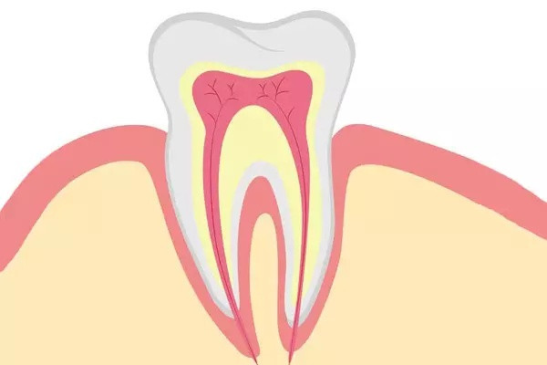 錯(cuò)頜有哪些矯正方法 錯(cuò)頜矯正器有哪些 錯(cuò)頜有哪些矯正方法 錯(cuò)頜矯正器有哪些