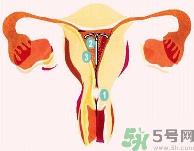 上環(huán)的最佳時(shí)間是什么時(shí)候？上環(huán)的壞處是什么？