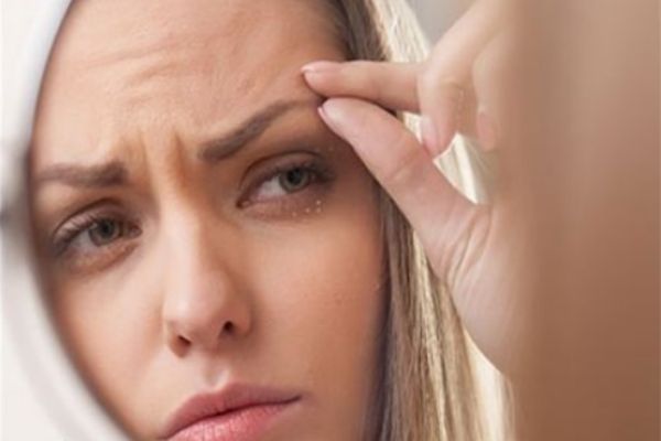 為什么眉毛處愛長痘 眉毛周圍長痘是什么原因