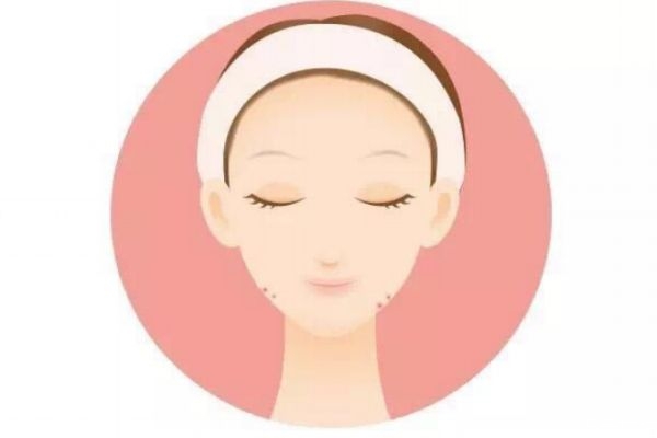 太陽穴為什么老長(zhǎng)痘痘呢 太陽穴長(zhǎng)痘痘原因是什么呢 太陽穴為什么老長(zhǎng)痘痘呢 太陽穴長(zhǎng)痘痘原因是什么呢