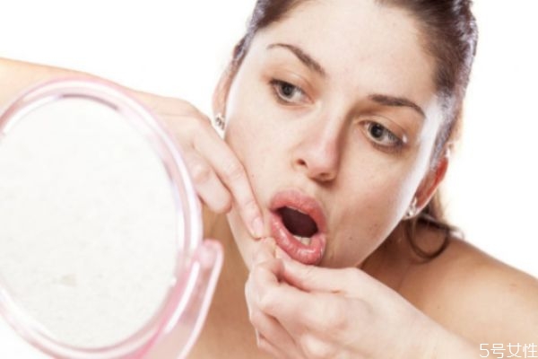 經(jīng)期如何預(yù)防長(zhǎng)痘 經(jīng)期長(zhǎng)痘的注意事項(xiàng)