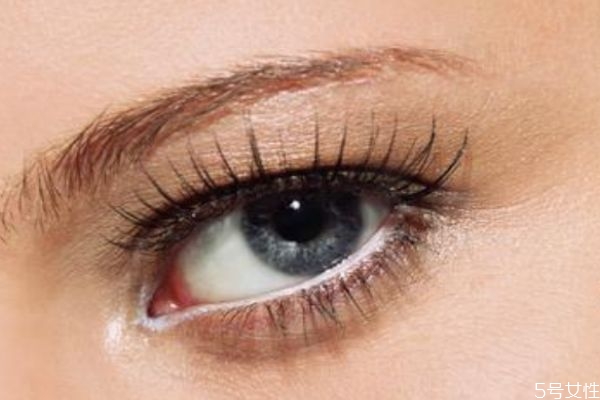 開眼角多久可以恢復(fù)呢 開眼角什么時(shí)候看沾水呢 開眼角多久可以恢復(fù)呢 開眼角什么時(shí)候看沾水呢