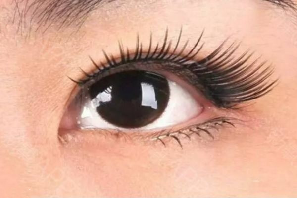 上瞼提肌是什么 上瞼提肌的意義 上瞼提肌是什么 上瞼提肌的意義