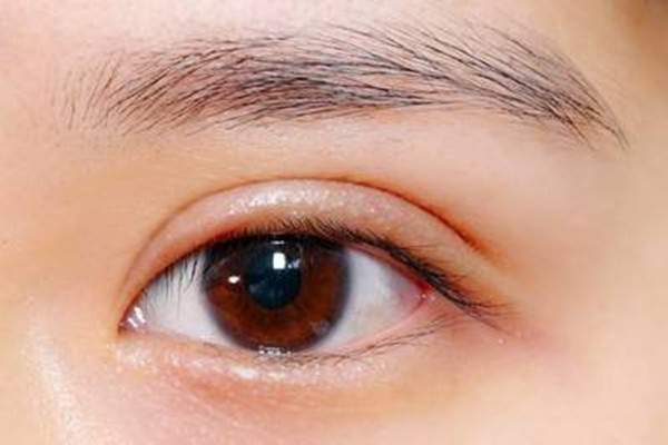 上瞼提肌是什么 上瞼提肌的意義 上瞼提肌是什么 上瞼提肌的意義