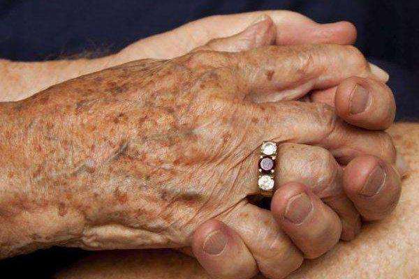 老年斑有什么危害 出現(xiàn)老年斑該怎么護(hù)理 老年斑有什么危害 出現(xiàn)老年斑該怎么護(hù)理