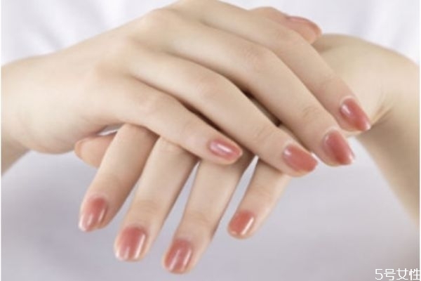 凍瘡怎么根治 凍瘡的防與治