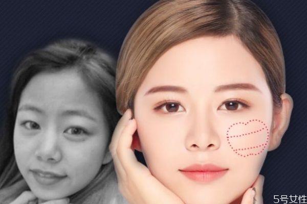 什么是蘋果肌呢 蘋果肌有什么作用呢 什么是蘋果肌呢 蘋果肌有什么作用呢