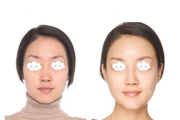 如何擁有蘋果肌呢 蘋果肌都是天生的嗎 如何擁有蘋果肌呢 蘋果肌都是天生的嗎