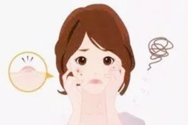 臉上剛擠完痘怎么辦 臉上剛擠完痘要注意什么 臉上剛擠完痘怎么辦 臉上剛擠完痘要注意什么