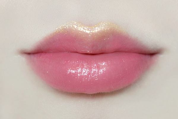 唇形有哪幾種 什么是自體脂肪豐唇術(shù) 唇形有哪幾種 什么是自體脂肪豐唇術(shù)