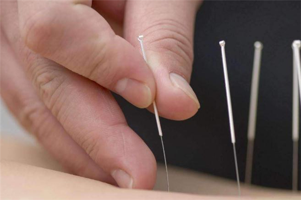 針灸減肥價(jià)格是多少 針灸減肥會(huì)反彈嗎 針灸減肥價(jià)格是多少 針灸減肥會(huì)反彈嗎