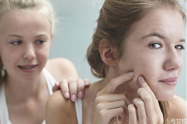 如何度過刷酸爆痘期 刷酸爆痘周期是多久 如何度過刷酸爆痘期 刷酸爆痘周期是多久