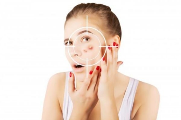 擠掉痘痘后紅腫怎么消 快速消除紅腫的痘痘 擠掉痘痘后紅腫怎么消 快速消除紅腫的痘痘