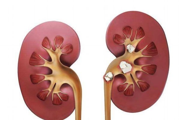 什么是腎衰竭呢 腎衰竭有什么危害呢 什么是腎衰竭呢 腎衰竭有什么危害呢