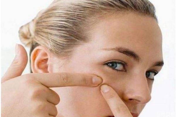 血熱長痘吃什么好 痘痘位置詳解 血熱長痘吃什么好 痘痘位置詳解