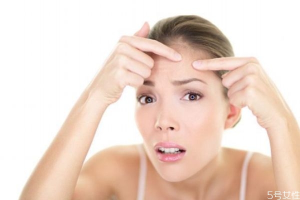 下巴長痘痘怎么消除 怎樣健康去痘痘 下巴長痘痘怎么消除 怎樣健康去痘痘