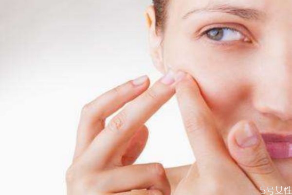 血熱長痘吃什么好 痘痘位置詳解 血熱長痘吃什么好 痘痘位置詳解