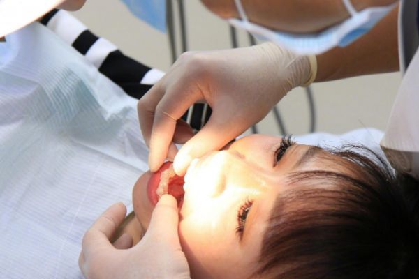 拔牙后能吃冰激凌嗎 拔牙一般會(huì)拔哪種牙