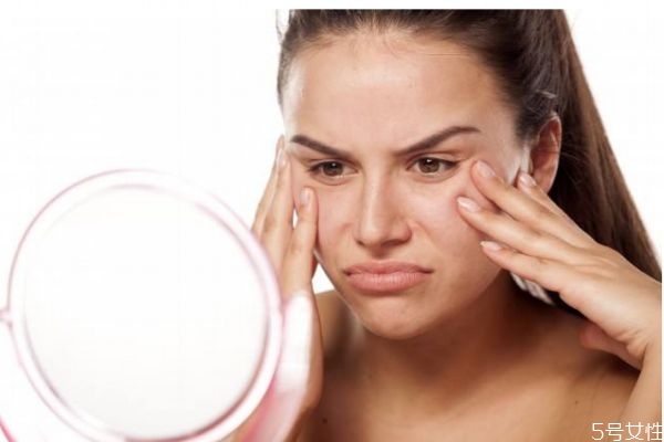 為什么額頭會有閉口粉刺呢 造成額頭閉口粉刺是什么呢 為什么額頭會有閉口粉刺呢 造成額頭閉口粉刺是什么呢