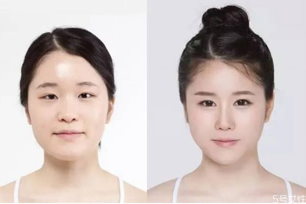 墊鼻子有什么危害呢 墊鼻子老了以后會(huì)怎么樣呢 墊鼻子有什么危害呢 墊鼻子老了以后會(huì)怎么樣呢