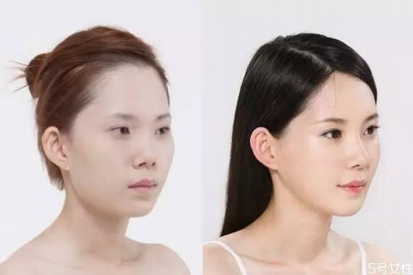 墊鼻子有什么危害呢 墊鼻子老了以后會(huì)怎么樣呢 墊鼻子有什么危害呢 墊鼻子老了以后會(huì)怎么樣呢