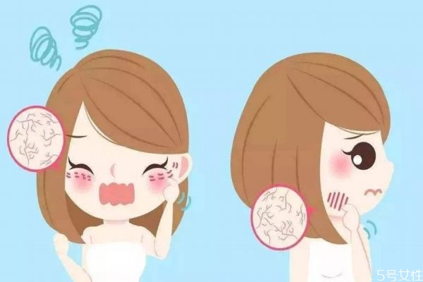 什么是敏感肌膚呢 敏感肌膚有什么特點(diǎn)呢 什么是敏感肌膚呢 敏感肌膚有什么特點(diǎn)呢