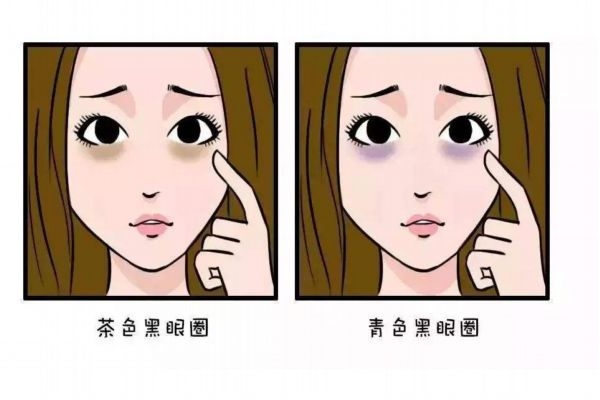 黑眼圈會(huì)自愈嗎 如何去除黑眼圈呢 黑眼圈會(huì)自愈嗎 如何去除黑眼圈呢