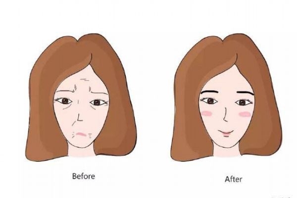 什么是笑紋呢 笑紋是怎么樣的呢 什么是笑紋呢 笑紋是怎么樣的呢