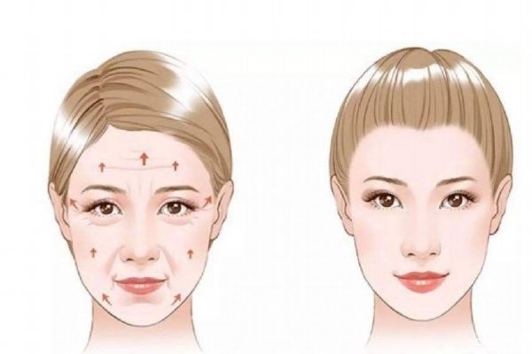 木偶紋出現(xiàn)的主要原因有什么呢 如果消除木偶紋呢 木偶紋出現(xiàn)的主要原因有什么呢 如果消除木偶紋呢