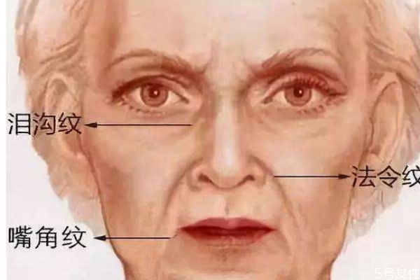 什么是淚溝紋呢 淚溝紋是怎么形成的呢 什么是淚溝紋呢 淚溝紋是怎么形成的呢