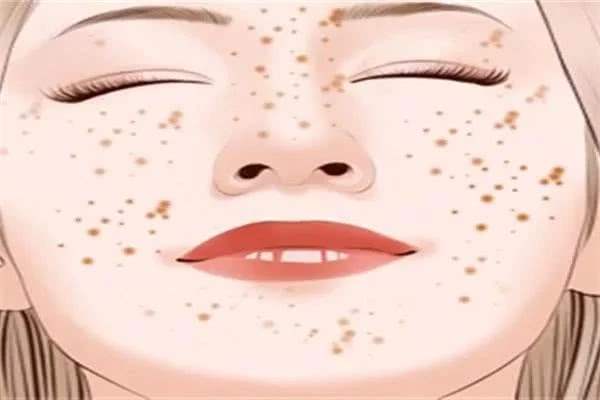 黑色素形成的原因 怎樣抑制黑色素生長 黑色素形成的原因 怎樣抑制黑色素生長