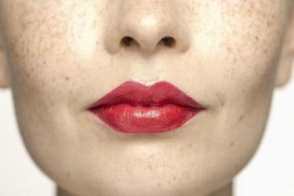 產(chǎn)婦臉上為什么會長斑 產(chǎn)后臉上的斑要多久才消失 產(chǎn)婦臉上為什么會長斑 產(chǎn)后臉上的斑要多久才消失