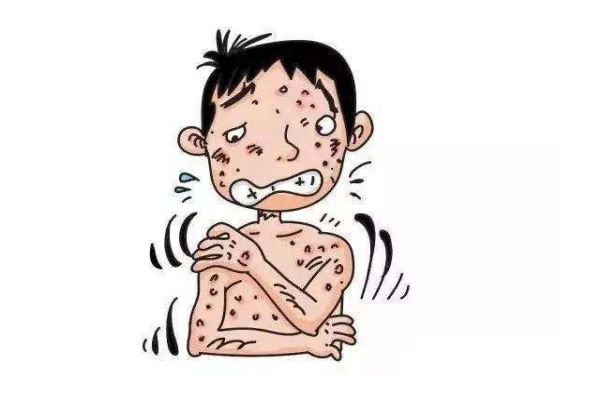 什么是肺結(jié)核呢 肺結(jié)核有什么危害呢 什么是肺結(jié)核呢 肺結(jié)核有什么危害呢