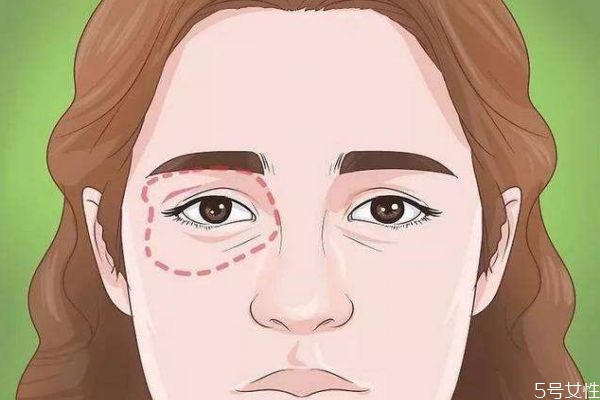 黑眼圈是怎么產生的呢 天生的黑眼圈是怎么造成的呢