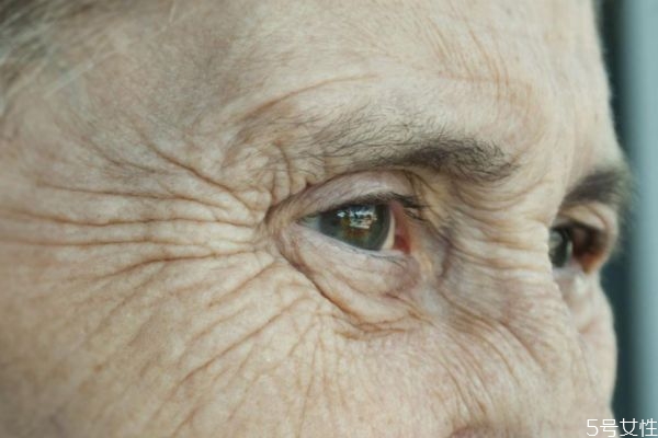 預(yù)防皺紋的方法有什么呢 如何能有效預(yù)防皺紋呢 預(yù)防皺紋的方法有什么呢 如何能有效預(yù)防皺紋呢