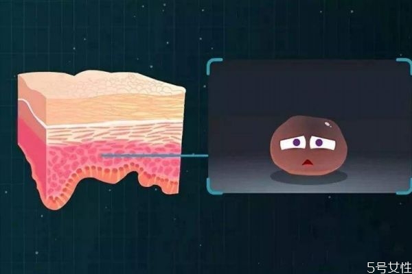 角質(zhì)層比較厚會(huì)怎么樣呢 角質(zhì)層薄厚有什么區(qū)別呢