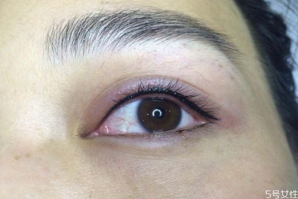 為什么眼睛中會有紅血絲呢 眼睛中紅血絲是怎么造成呢 為什么眼睛中會有紅血絲呢 眼睛中紅血絲是怎么造成呢