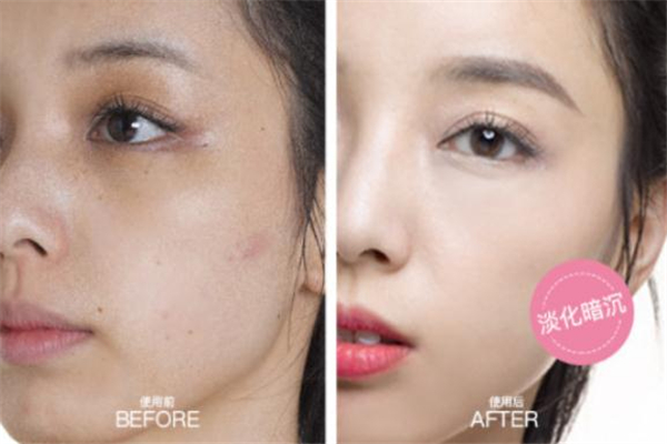 芙蓉肌素顏霜怎么樣 芙蓉肌素顏霜好用嗎 芙蓉肌素顏霜怎么樣 芙蓉肌素顏霜好用嗎