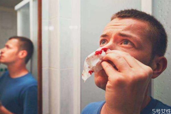 鼻子出血應(yīng)該怎么辦呢 鼻子出血如何治療呢 鼻子出血應(yīng)該怎么辦呢 鼻子出血如何治療呢