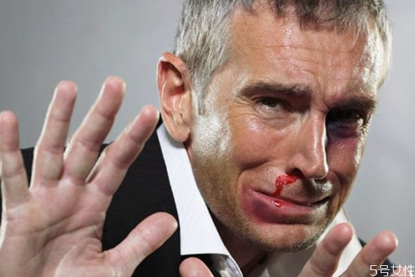 鼻子出血應(yīng)該怎么辦呢 鼻子出血如何治療呢 鼻子出血應(yīng)該怎么辦呢 鼻子出血如何治療呢