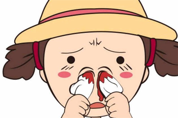 為什么會流鼻血 流鼻血止不住怎么辦 為什么會流鼻血 流鼻血止不住怎么辦