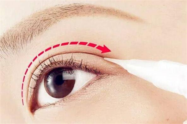 雙眼皮定型霜怎么用 雙眼皮定型霜怎么卸 雙眼皮定型霜怎么用 雙眼皮定型霜怎么卸