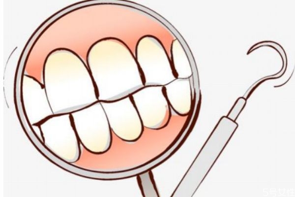 年輕人牙齒松動應(yīng)該怎么辦呢 年輕人牙齒松動應(yīng)該怎么辦呢
