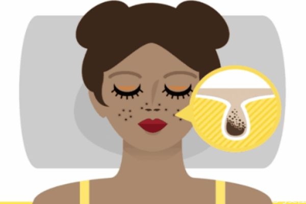 如何去黑頭呢 去黑頭的辦法有什么呢 如何去黑頭呢 去黑頭的辦法有什么呢