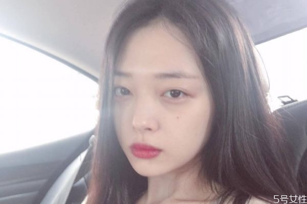 下巴打了玻尿酸有硬塊怎么回事 玻尿酸打下巴會(huì)硬幾天 下巴打了玻尿酸有硬塊怎么回事 玻尿酸打下巴會(huì)硬幾天