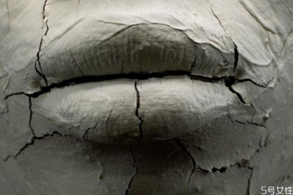 什么是唇炎呢 唇炎有什么危害呢