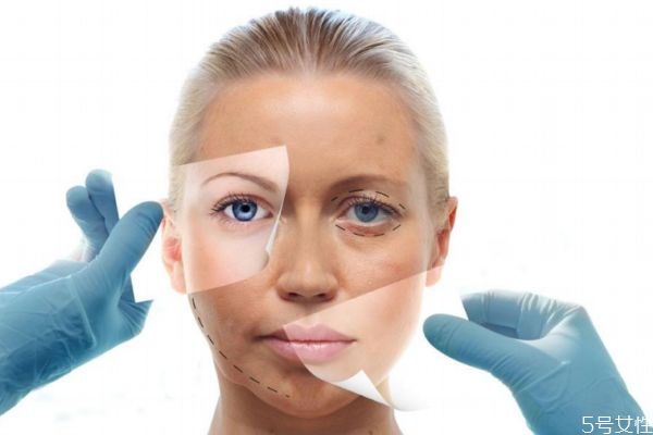 皮膚松弛的原因有什么呢 為什么會(huì)皮膚松弛呢 皮膚松弛的原因有什么呢 為什么會(huì)皮膚松弛呢