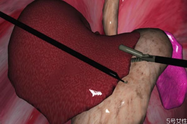 什么是肝囊腫呢 肝囊腫有什么危害呢 什么是肝囊腫呢 肝囊腫有什么危害呢