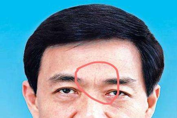 什么是懸針紋 如何預(yù)防懸針紋出現(xiàn) 什么是懸針紋 如何預(yù)防懸針紋出現(xiàn)