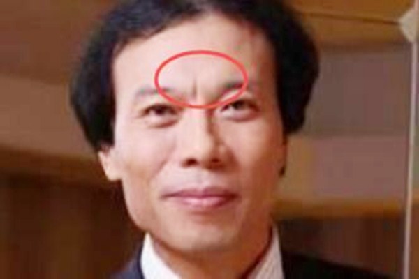 什么是懸針紋 如何預(yù)防懸針紋出現(xiàn) 什么是懸針紋 如何預(yù)防懸針紋出現(xiàn)